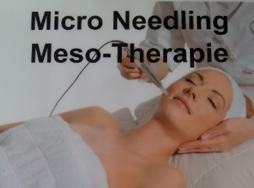 Micro-Needling